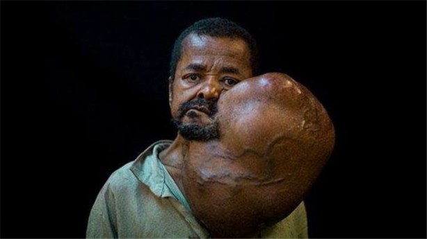 Foto - Tuhaf tıp olayları!