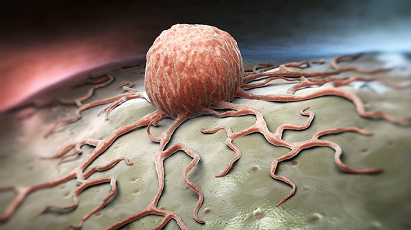 Foto - TÜİK açıklama yaptı! İşte Türkiye'nin kanser haritası