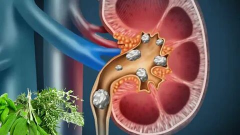 Foto - Tükettiğiniz anda böbrek taşına neden oluyor! Bu zararını bilmeden tüketiyoruz