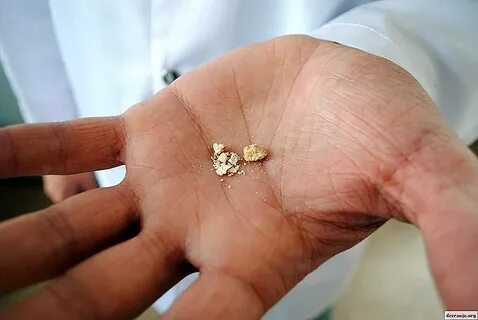 Foto - Tükettiğiniz anda böbrek taşına neden oluyor! Bu zararını bilmeden tüketiyoruz