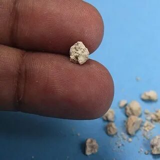 Foto - Tükettiğiniz anda böbrek taşına neden oluyor! Bu zararını bilmeden tüketiyoruz