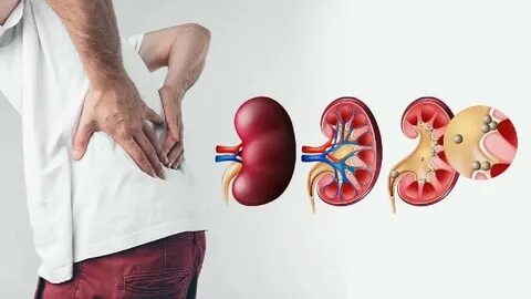 Foto - Tükettiğiniz anda böbrek taşına neden oluyor! Bu zararını bilmeden tüketiyoruz