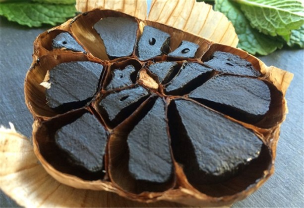 Foto - Siyah sarımsak görmüş müydünüz?