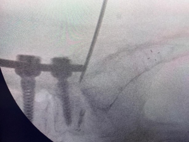 Foto - Türk doktordan müthiş buluş! Dünya şok oldu