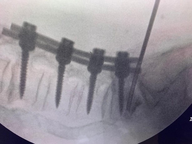 Türk doktordan müthiş buluş! Dünya şok oldu
