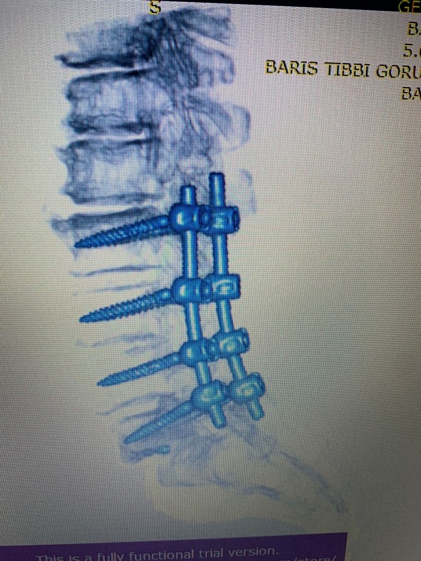 Foto - Türk doktordan müthiş buluş! Dünya şok oldu