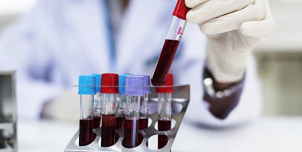 Türk hekimden müthiş buluş! Kan testi artık tarihe karışacak