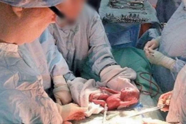 Foto - Türk nüfusunu bitirecekler! Çin, Uygurlu kadınlara bunu da yaptı!