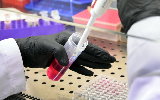 Foto - Türk profesör geliştirdi Kanser tedavisinde devrim gibi buluş