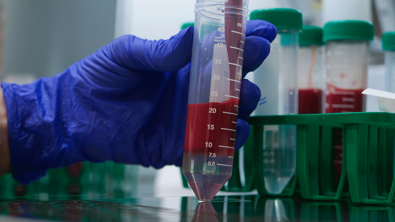 Foto - Türk ve Amerikan bilim insanları ortak aşı geliştiriyor!