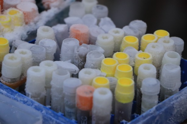 Foto - Türkiye için çok önemli bir koleksiyon... Bir bir ve bu kez olacak...