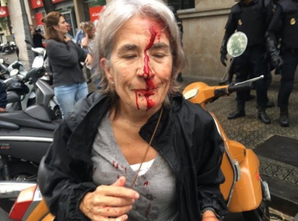 Foto - Türkiye kınamak için yarışa girenlerin portresi! ABD ve Avrupa polisinden orantısız güç