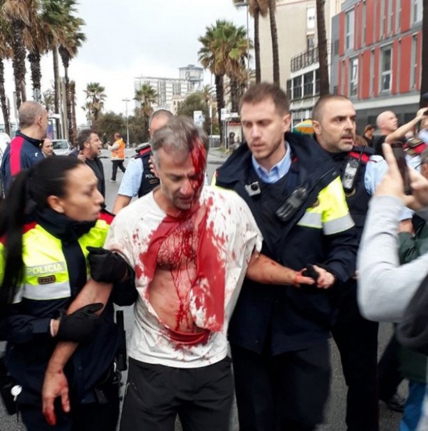 Foto - Türkiye kınamak için yarışa girenlerin portresi! ABD ve Avrupa polisinden orantısız güç