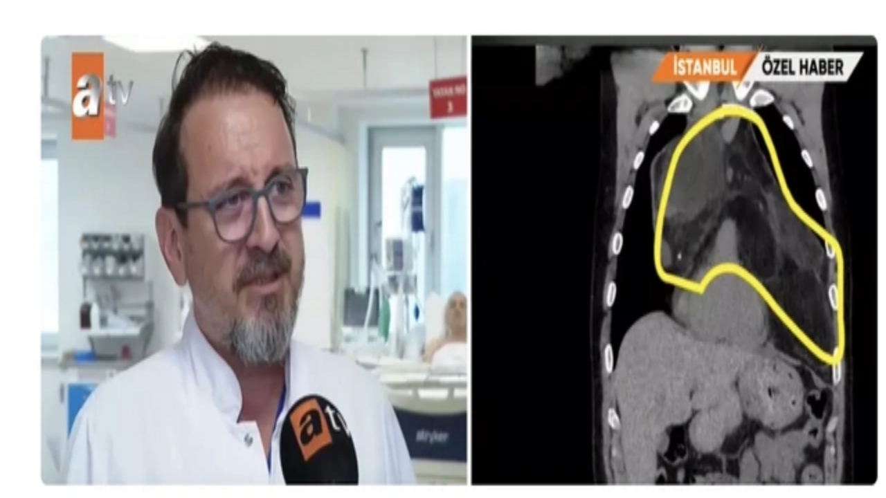 Foto - Türkiye’de bilinen en büyük vaka! Kendisi de doktorlar da gözlerine inanamadı: "Şok geçirdim"
