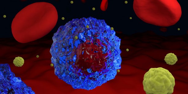 Foto - Türkiye'de en çok ölüme yol açan ikinci hastalık