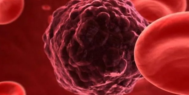 Türkiye'de en çok ölüme yol açan ikinci hastalık