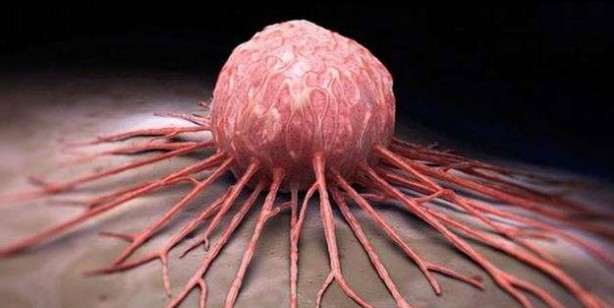 Foto - Türkiye'de en çok ölüme yol açan ikinci hastalık