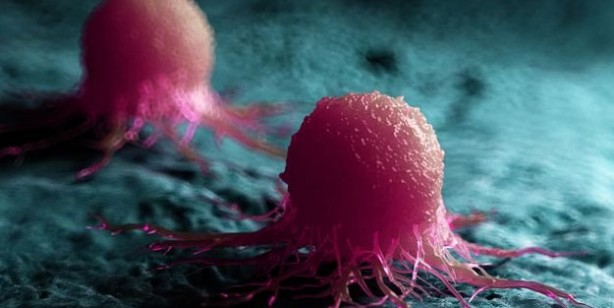 Foto - Türkiye'de en çok ölüme yol açan ikinci hastalık