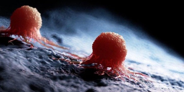 Foto - Türkiye'de en çok ölüme yol açan ikinci hastalık