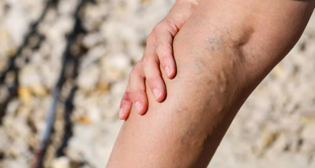 Foto - Türkiye’de her 2 kişiden 1’inde var! Önlem alınmazsa büyük tehlike