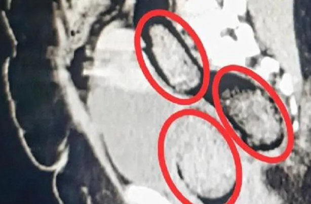 Foto - Türkiye'de idam şart! Kadın yolcunun makatından bakın ne çıktı