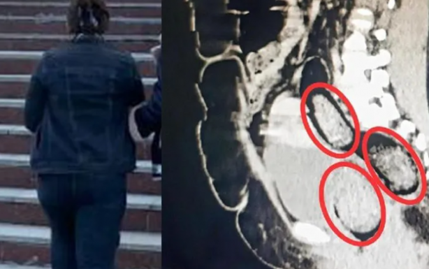 Foto - Türkiye'de idam şart! Kadın yolcunun makatından bakın ne çıktı