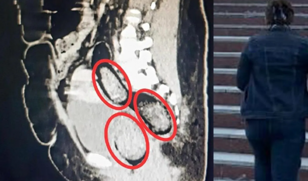 Foto - Türkiye'de idam şart! Kadın yolcunun makatından bakın ne çıktı