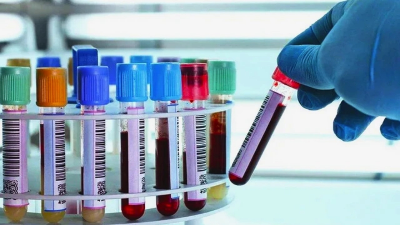 Foto - Türkiye’de nüfusun yüzde 35’e yakınının taşıdığı bu kan grubuna sahip olanlar dikkat! Çaresi belli oldu