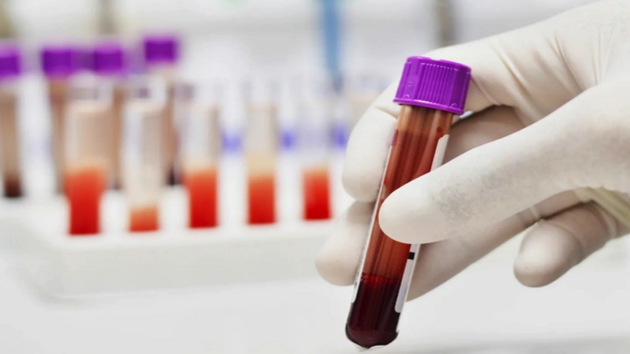 Foto - Türkiye’de nüfusun yüzde 35’e yakınının taşıdığı bu kan grubuna sahip olanlar dikkat! Çaresi belli oldu