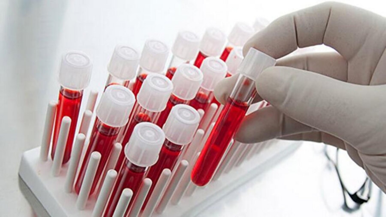 Foto - Türkiye’de nüfusun yüzde 35’e yakınının taşıdığı bu kan grubuna sahip olanlar dikkat! Çaresi belli oldu