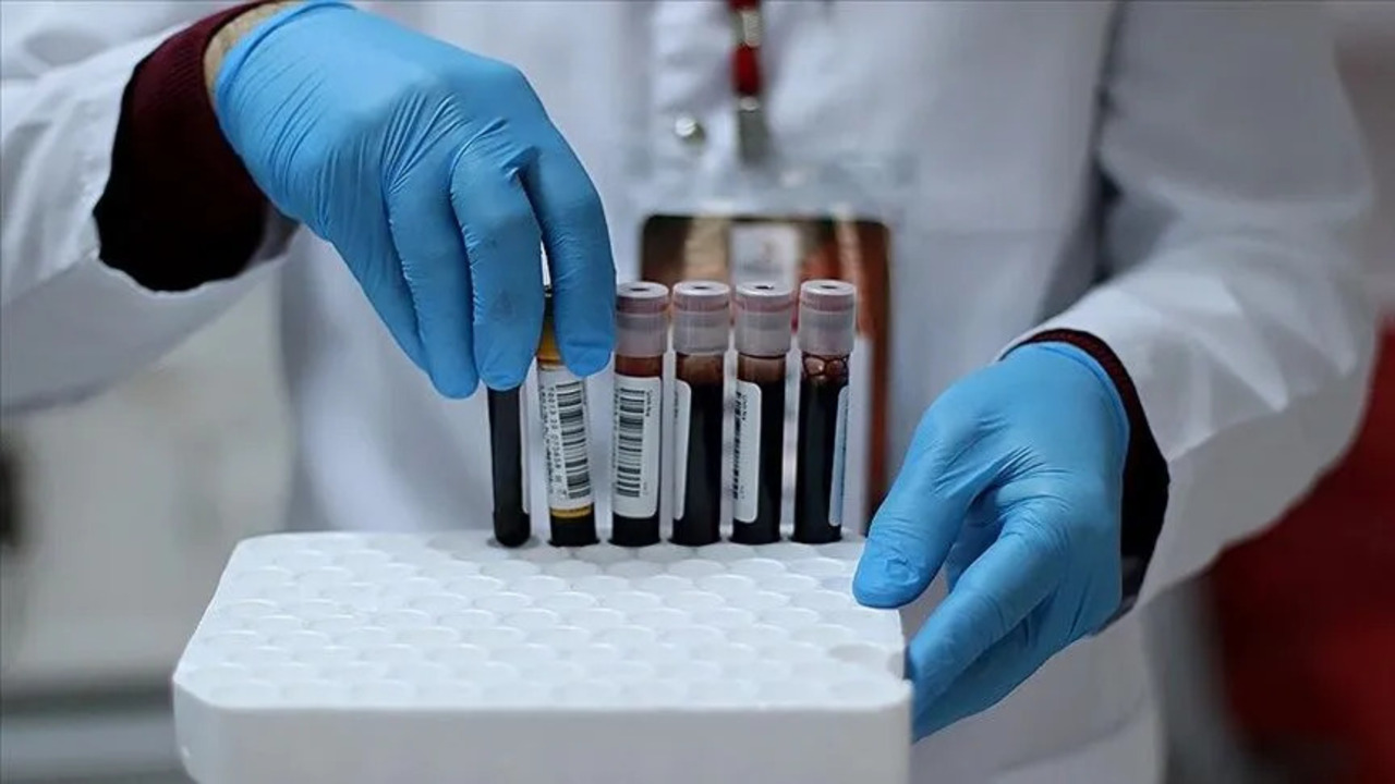 Türkiye'de seküler hayat tarzı patlak veriyor! HIV oranı 4 kat arttı!