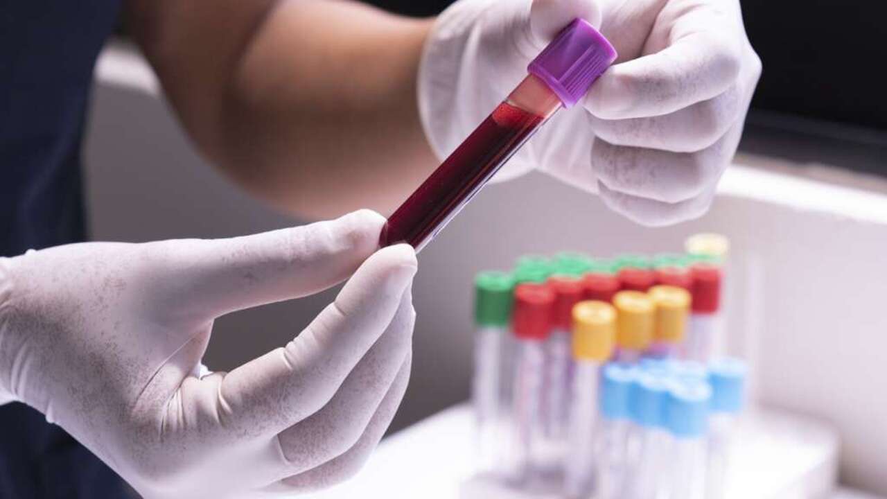 Foto - Türkiye'de seküler hayat tarzı patlak veriyor! HIV oranı 4 kat arttı!