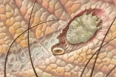 Foto - Türkiye'de uyuz alarmı! 6 ayda pik yaptı, tek çaresi var