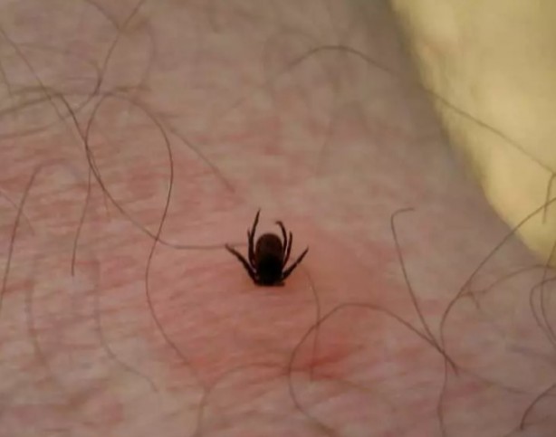 Foto - Türkiye'nin her yerinden ölüm haberleri geliyor! İşte keneden korunma yolları