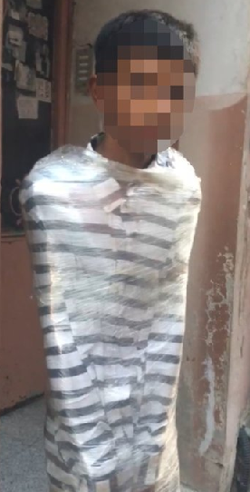 Foto - Türkiye'nin o ilinde akılalmaz olay: Motosiklet toplayan hırsız vatandaşı streçe sardı! Şaşkına çeviren görüntü