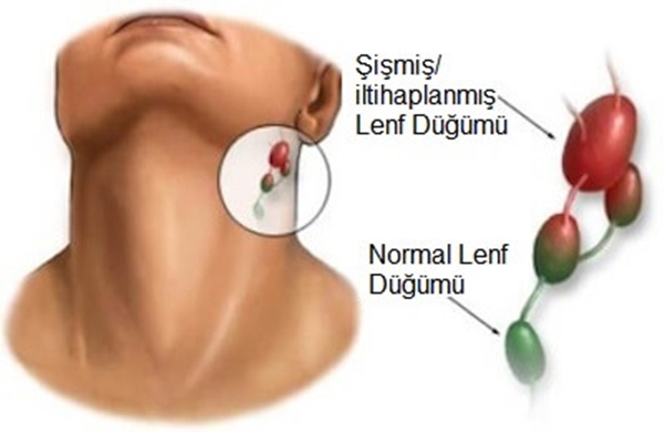 Foto - Türkiye'nin yüzde 18'i 'kronik yorgun'