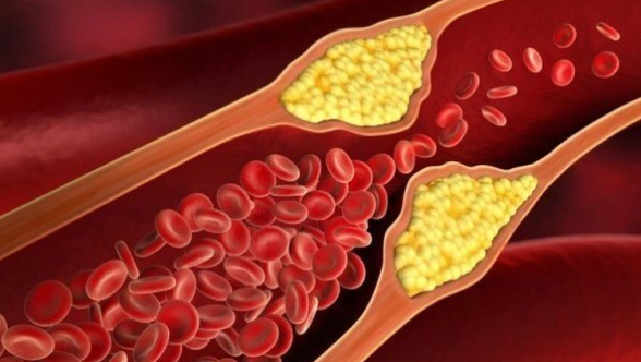 Foto - Türklerin beyaz altını! İşte o besin