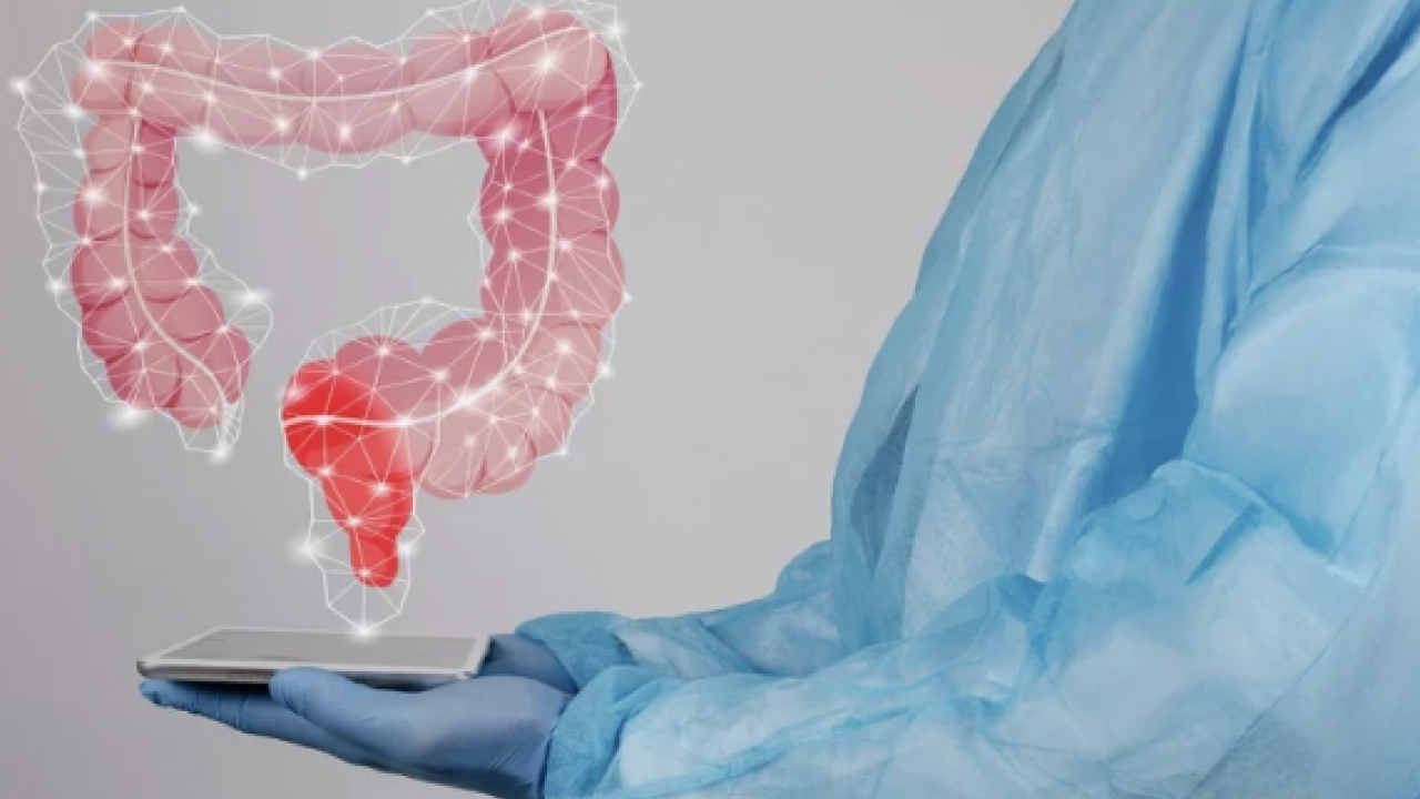 Tuvalette bu sorunu yaşıyorsanız dikkat! Bu belirti kolon kanseri habercisi olabilir... Uzmanı açıkaldı