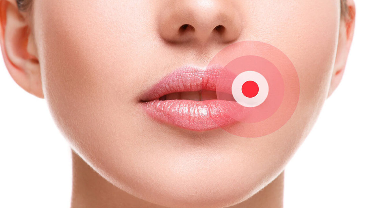 Foto - Uçuk virüsü tehlikesi ortaya çıktı! Bilim insanları gerçek bu diyerek duyurdular!