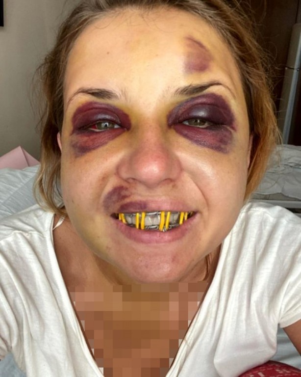 Foto - Ukraynalı ünlü sunucuya trende hem tecavüz hem şiddet!