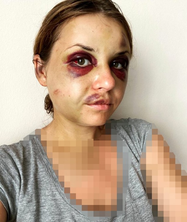 Foto - Ukraynalı ünlü sunucuya trende hem tecavüz hem şiddet!