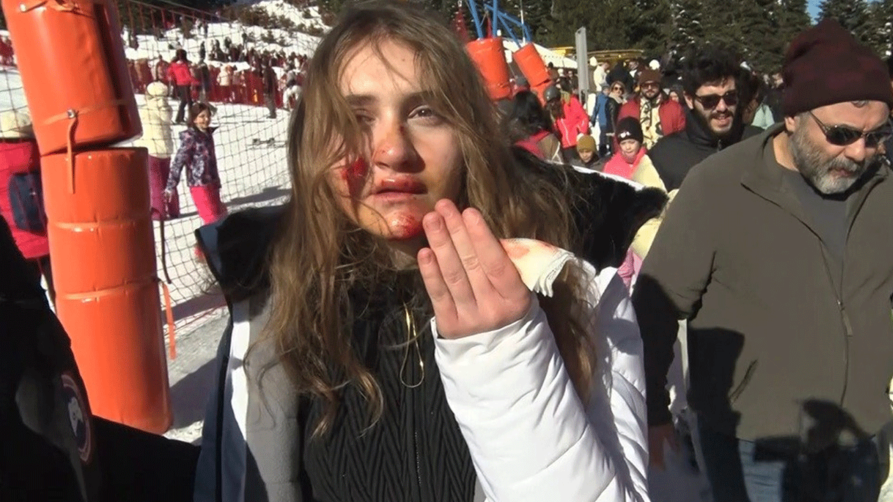 Foto - Uludağ'da ortalık kan revan! 