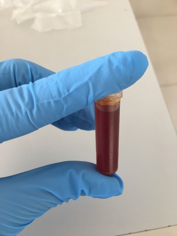 Foto - Umut ışığı yandı İşte göğüs kanseri hücrelerini yok eden besin