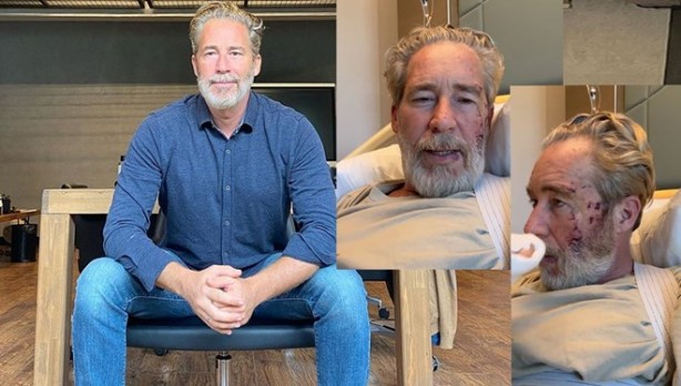 Ünlü oyuncu Sinan Albayrak dizi setinde korkunç bir kaza geçirmişti! "İsrail" detayı şok etti! Böyle açıkladı