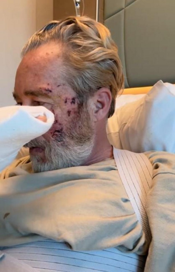 Foto - Ünlü oyuncu Sinan Albayrak dizi setinde korkunç bir kaza geçirmişti! "İsrail" detayı şok etti! Böyle açıkladı