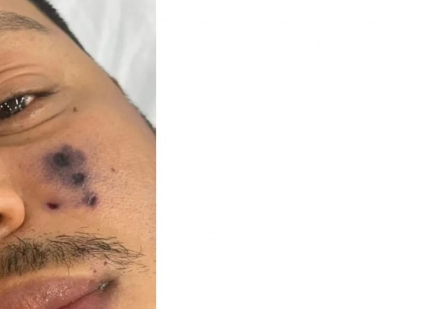 Foto - Ünlü şarkıcıdan acı haber! Feci şekilde can verdi