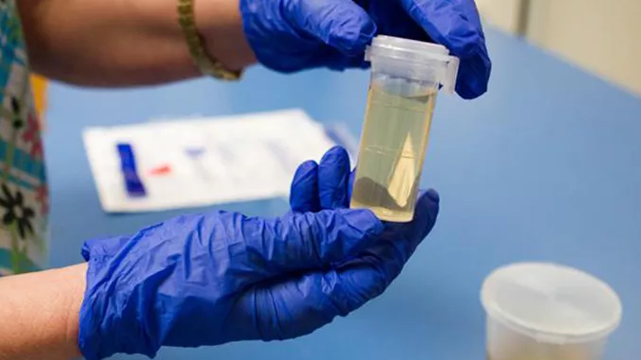 Ünlülere yönelik operasyonda gelişmeler sonrası merak edildi: Saçtan uyuşturucu testinde hangi uyuşturucular çıkar? 