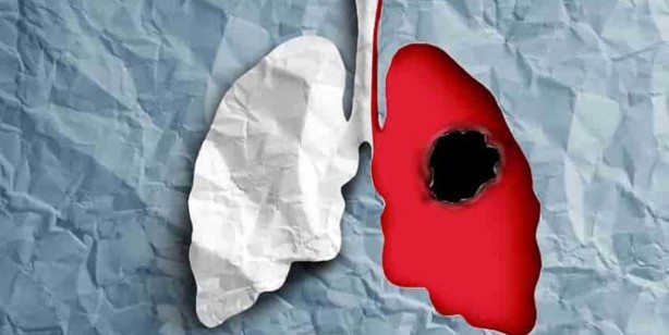 Foto - Unutkanlık sorunumu var? Bilişsel rezervi için işte çözümü! Tam bir servet: Herkes yapsın, kurtarıcı besinler...