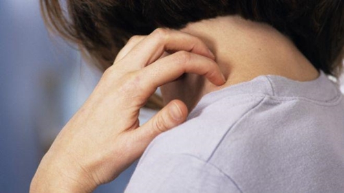 Foto - Ürtiker bahar aylarında artıyor!