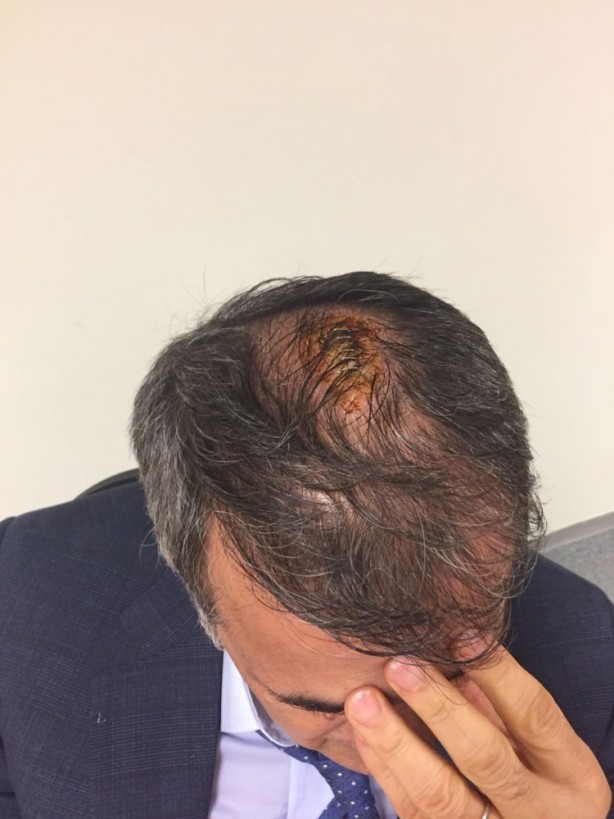 Foto - Utanç verici görüntüler... Futbol rezaleti...